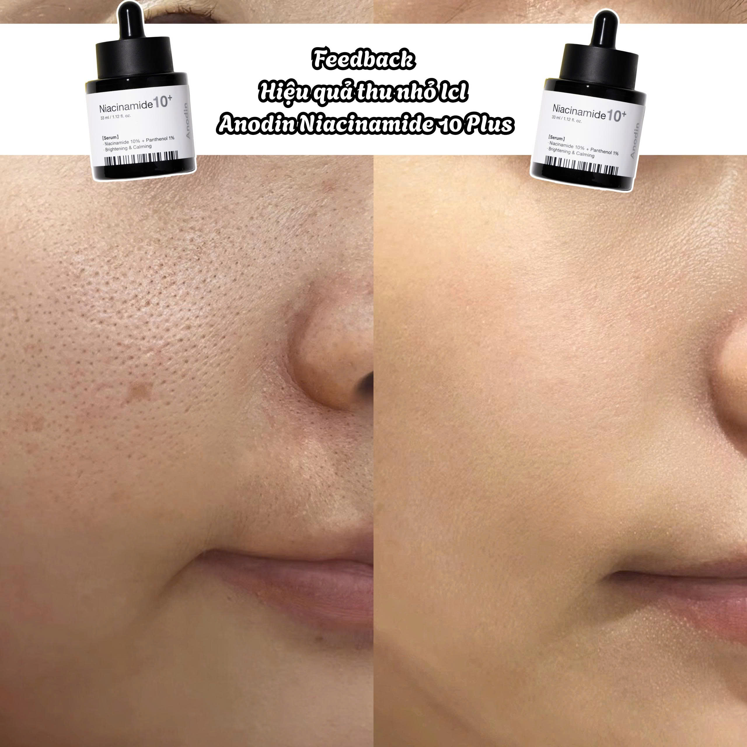Serum dưỡng sáng thu nhỏ lỗ chân lông Anodin Niacinamide 10 Plus 33ml - Image 4